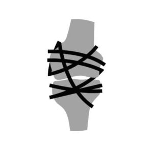 Stiffness