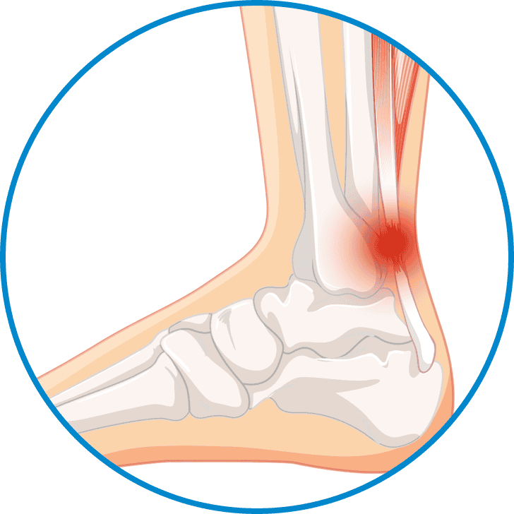 tendon4 tendon4